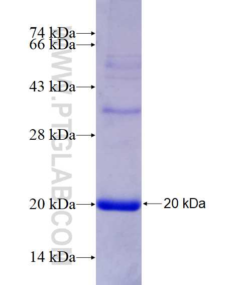 SRD5A1 fusion protein Ag23351 SDS-PAGE