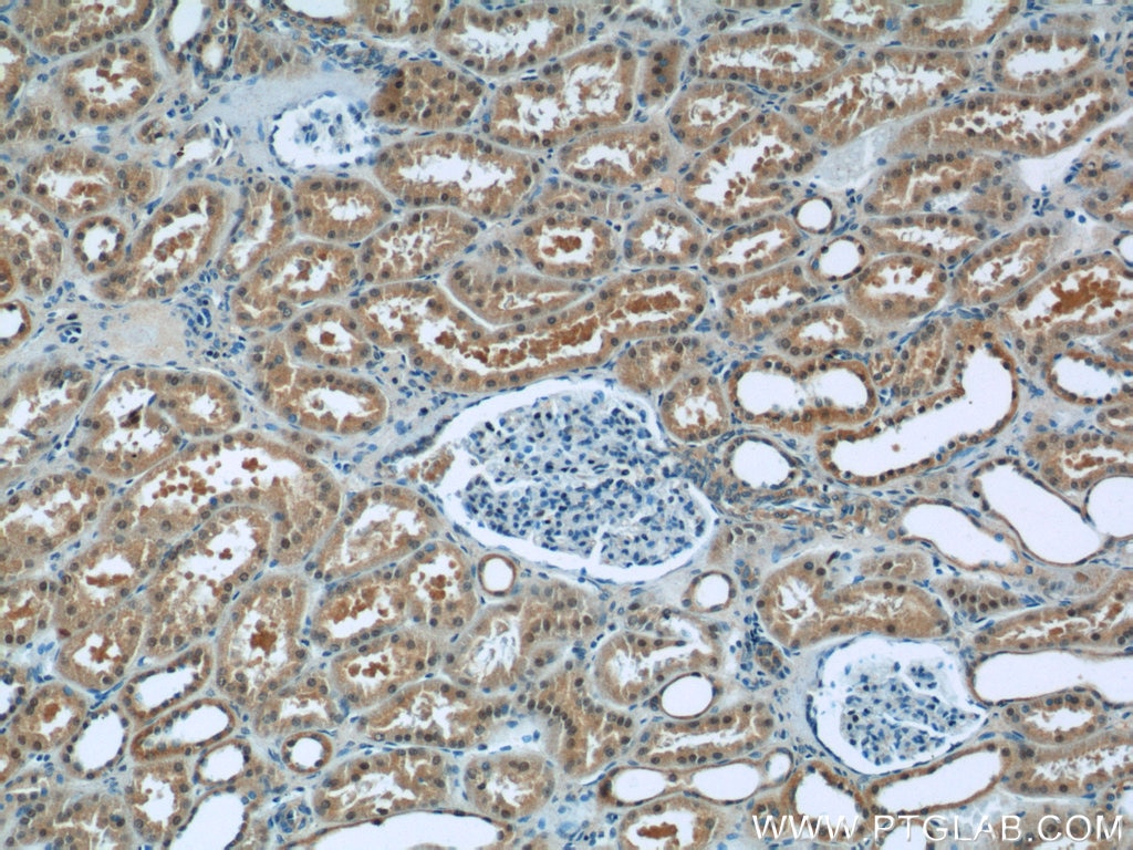 Immunohistochemistry (IHC) staining of human kidney tissue using SREBF1 Polyclonal antibody (14088-1-AP)