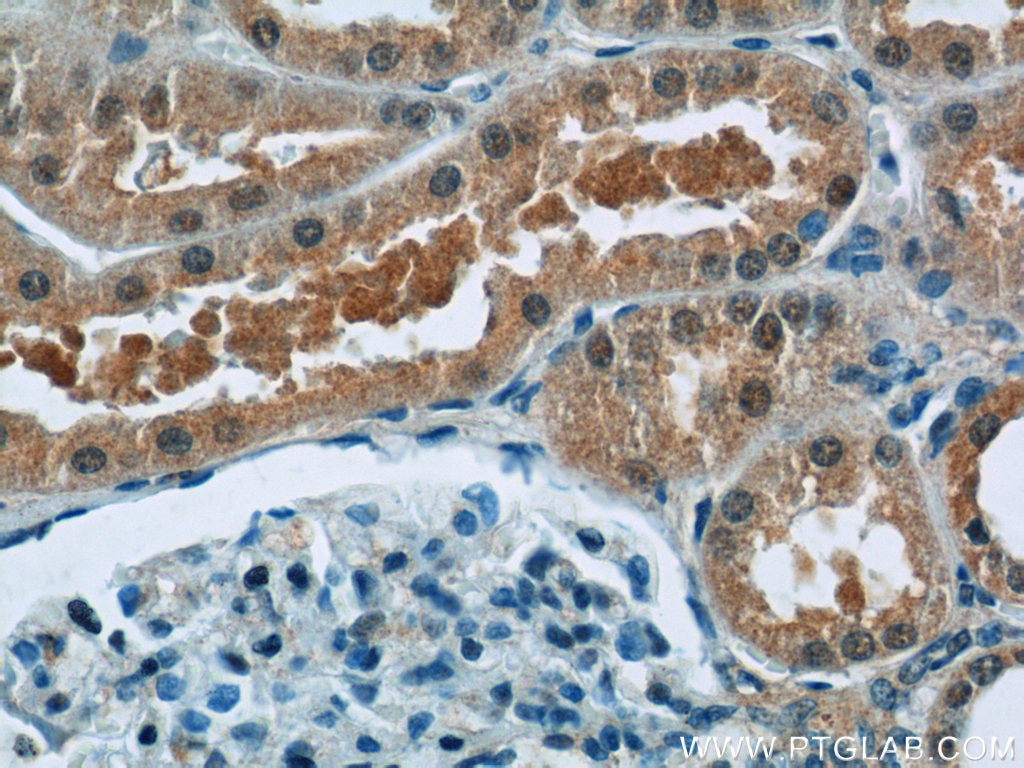 Immunohistochemistry (IHC) staining of human kidney tissue using SREBF1 Polyclonal antibody (14088-1-AP)
