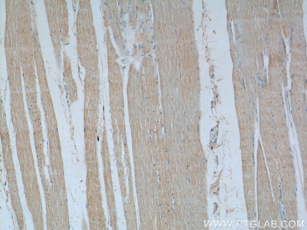 Immunohistochemistry (IHC) staining of human skeletal muscle tissue using SREBF1 Polyclonal antibody (14088-1-AP)