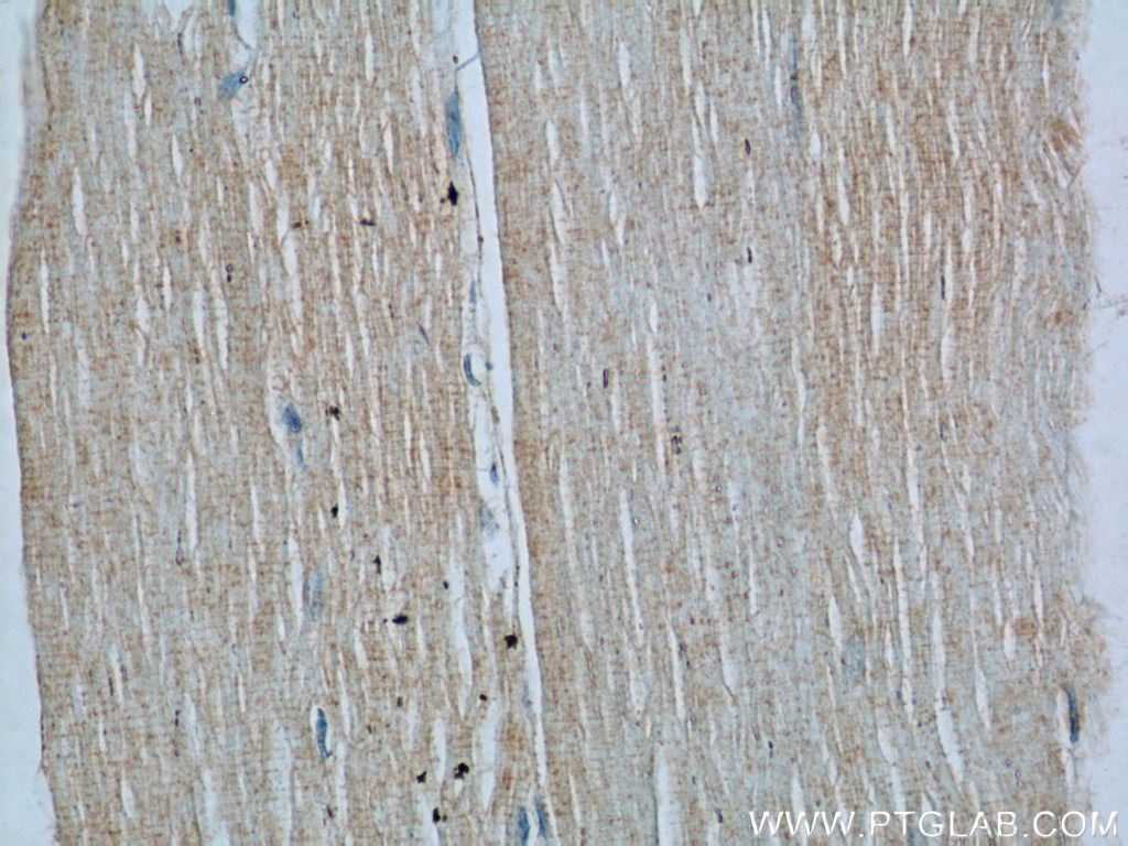 Immunohistochemistry (IHC) staining of human skeletal muscle tissue using SREBF1 Polyclonal antibody (14088-1-AP)