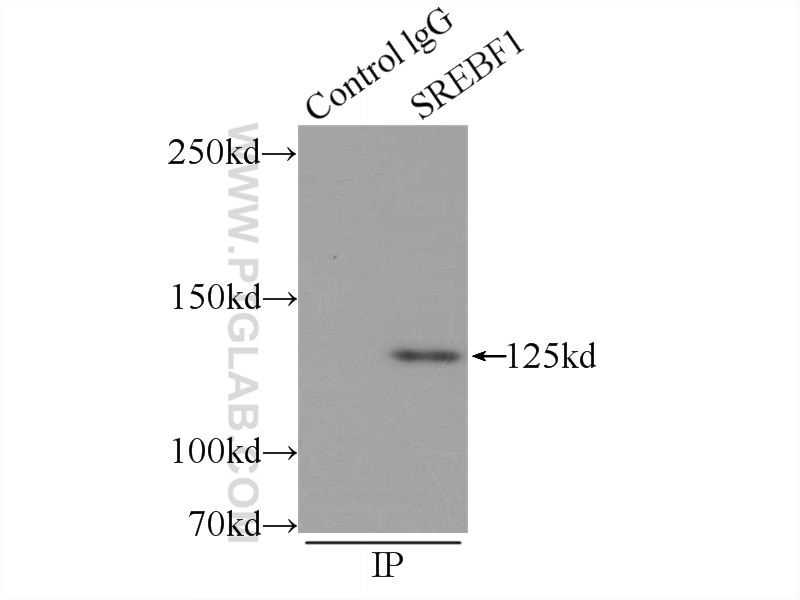 Immunoprecipitation (IP) experiment of L02 cells using SREBF1 Polyclonal antibody (14088-1-AP)
