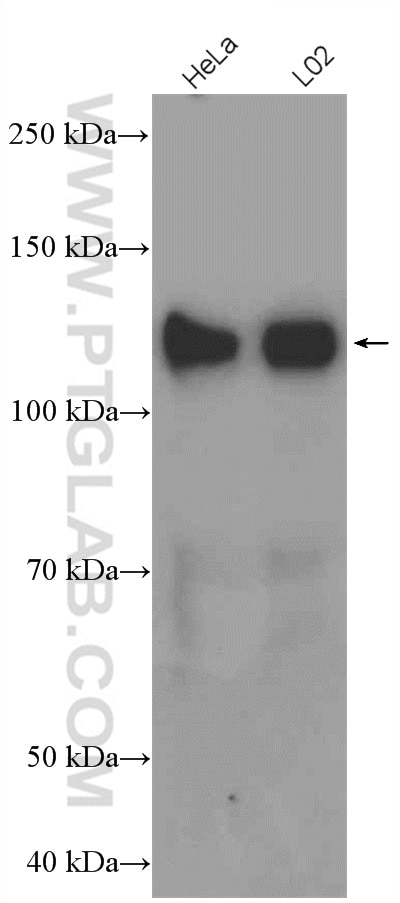 Western Blot (WB) analysis of various lysates using SREBF1 Polyclonal antibody (14088-1-AP)
