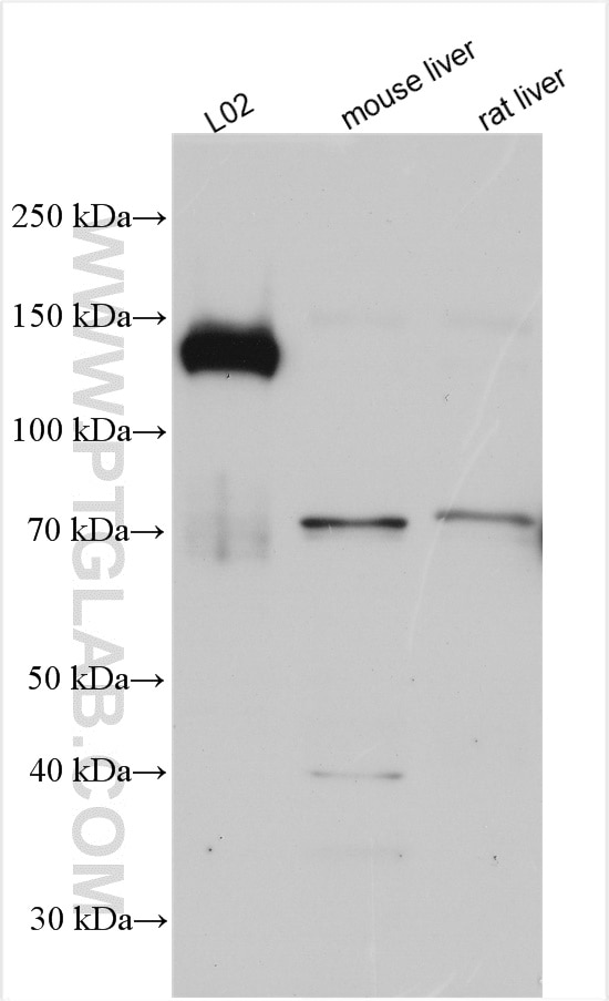 Western Blot (WB) analysis of various lysates using SREBF1 Polyclonal antibody (14088-1-AP)