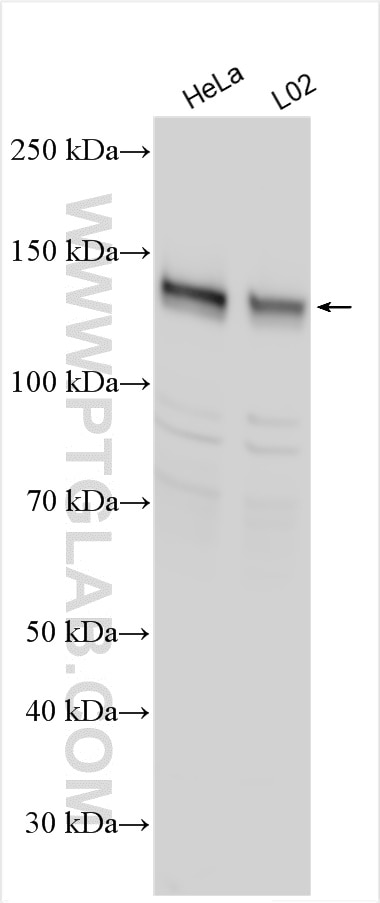 Western Blot (WB) analysis of various lysates using SREBF1 Polyclonal antibody (14088-1-AP)