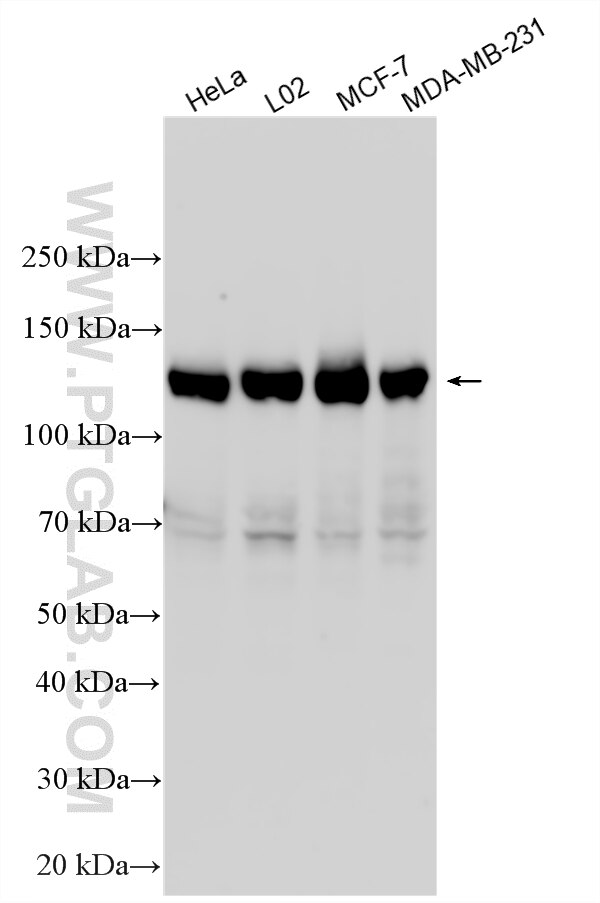 Western Blot (WB) analysis of various lysates using SREBF1 Polyclonal antibody (14088-1-AP)