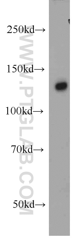 SREBF1 Polyclonal antibody