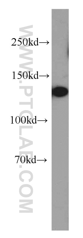 Western Blot (WB) analysis of HeLa cells using SREBF1 Polyclonal antibody (14088-1-AP)