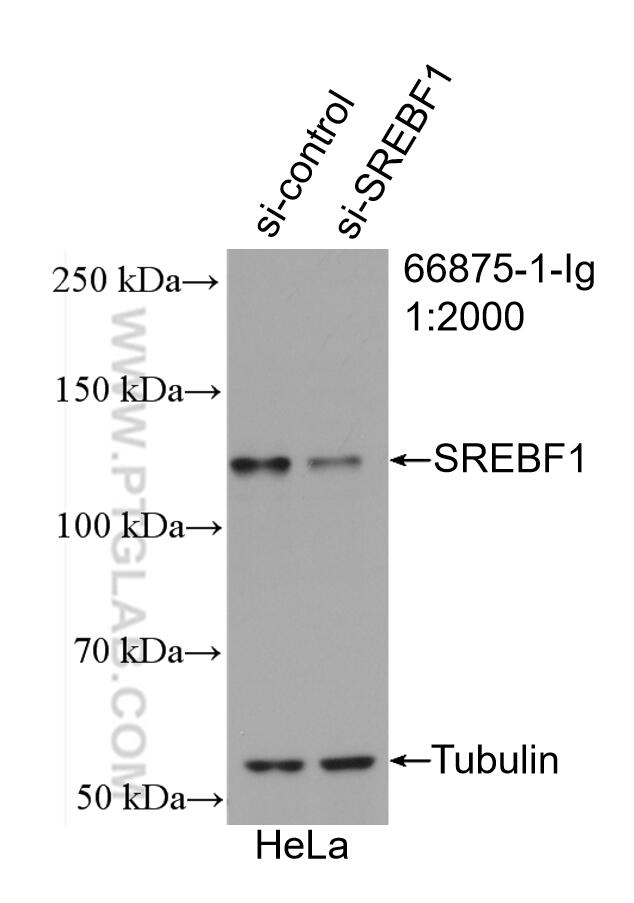 Western Blot (WB) analysis of HeLa cells using SREBF1 Monoclonal antibody (66875-1-Ig)