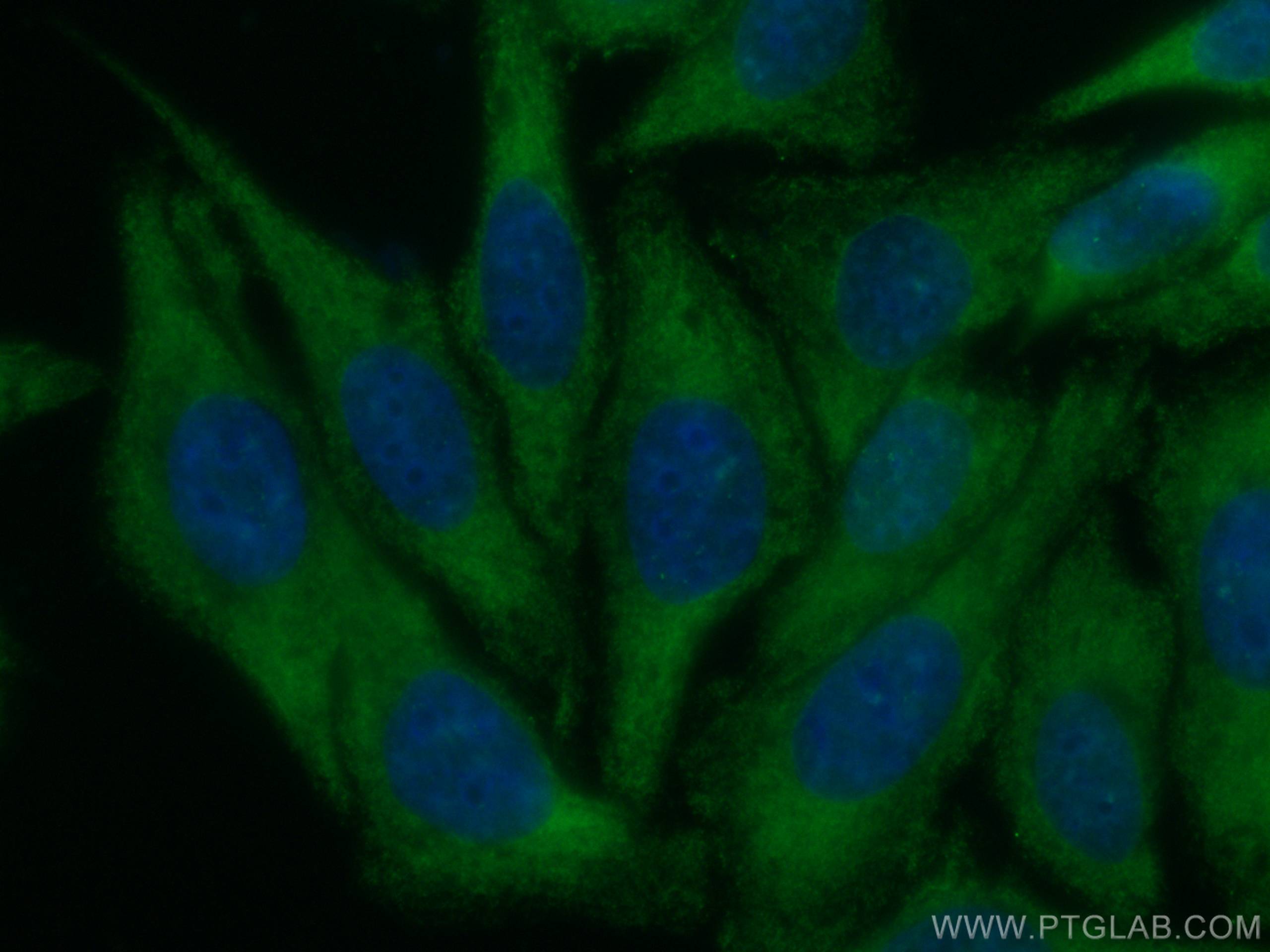 Immunofluorescence (IF) / fluorescent staining of HepG2 cells using CoraLite® Plus 488-conjugated SREBF1 Monoclonal an (CL488-66875)