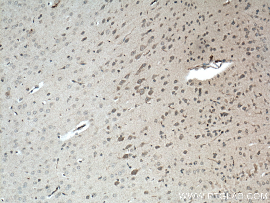 IHC staining of mouse brain using 14508-1-AP