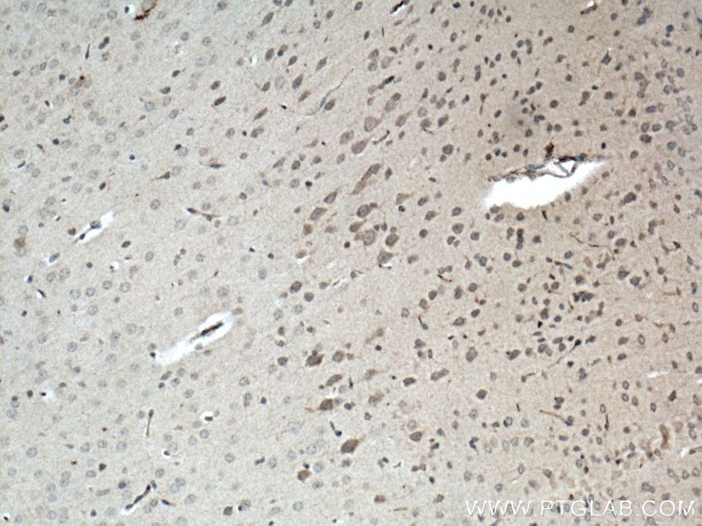 Immunohistochemistry (IHC) staining of mouse brain tissue using SREBF2 Polyclonal antibody (14508-1-AP)