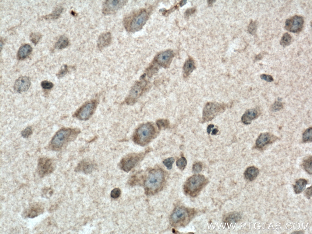 Immunohistochemistry (IHC) staining of mouse brain tissue using SREBF2 Polyclonal antibody (14508-1-AP)