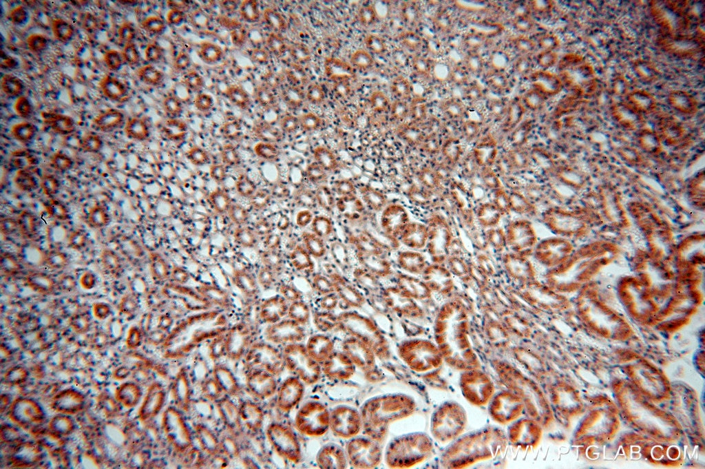 Immunohistochemistry (IHC) staining of human kidney tissue using SREBF2 Polyclonal antibody (14508-1-AP)