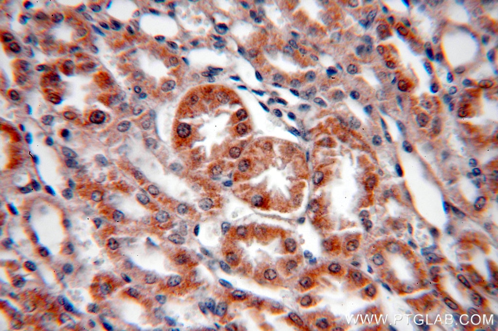 Immunohistochemistry (IHC) staining of human kidney tissue using SREBF2 Polyclonal antibody (14508-1-AP)