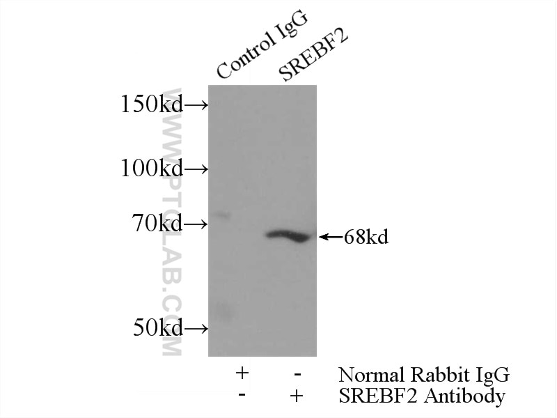 Immunoprecipitation (IP) experiment of HeLa cells using SREBF2 Polyclonal antibody (14508-1-AP)