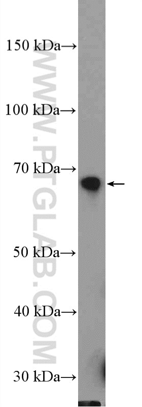 Western Blot (WB) analysis of rat liver tissue using SREBF2 Polyclonal antibody (14508-1-AP)