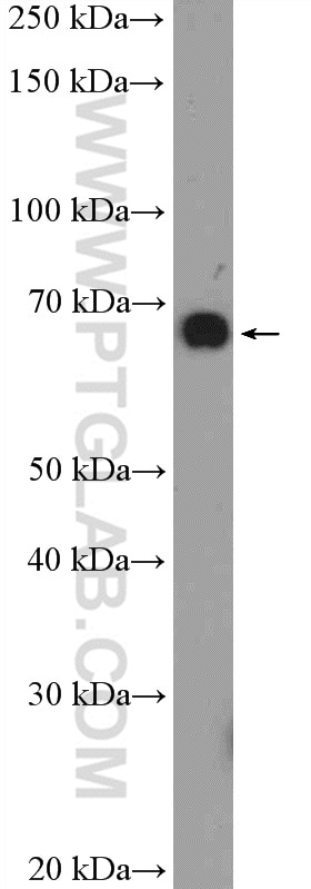 Western Blot (WB) analysis of mouse kidney tissue using SREBF2 Polyclonal antibody (14508-1-AP)
