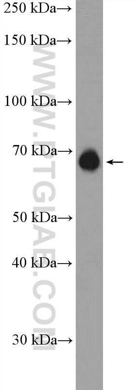 Western Blot (WB) analysis of rat kidney tissue using SREBF2 Polyclonal antibody (14508-1-AP)