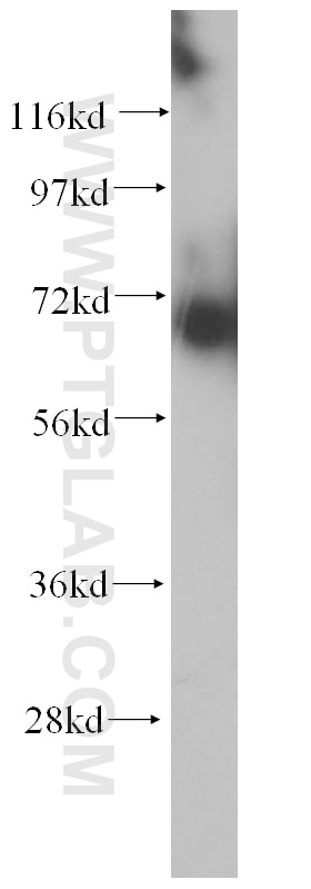 Western Blot (WB) analysis of human kidney tissue using SREBF2 Polyclonal antibody (14508-1-AP)