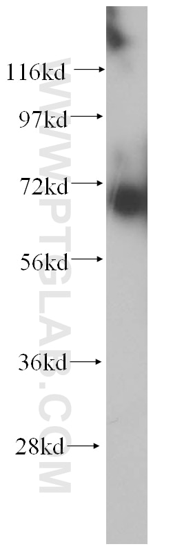 WB analysis of human kidney using 14508-1-AP