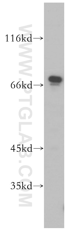 Western Blot (WB) analysis of Jurkat cells using SREBF2 Polyclonal antibody (14508-1-AP)