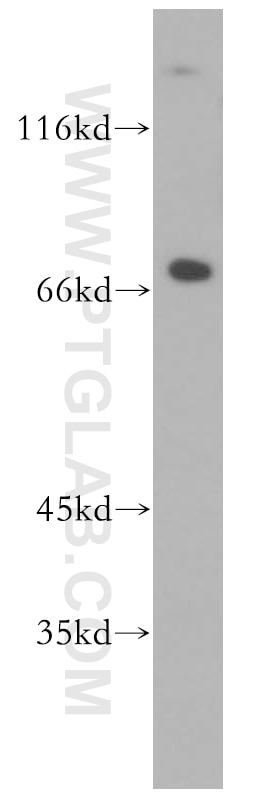 Western Blot (WB) analysis of HeLa cells using SREBF2 Polyclonal antibody (14508-1-AP)