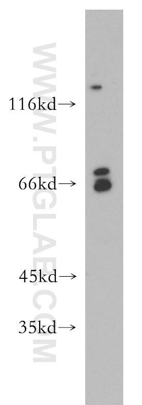 Western Blot (WB) analysis of HepG2 cells using SREBF2 Polyclonal antibody (14508-1-AP)