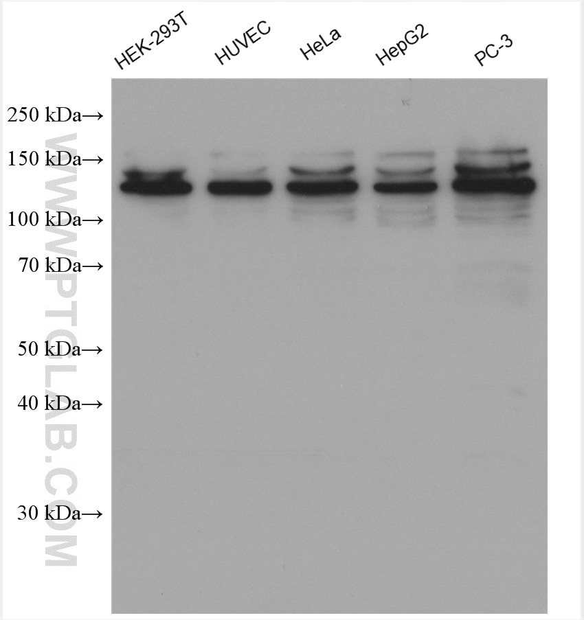 Western Blot (WB) analysis of various lysates using SREBF2 Polyclonal antibody (28212-1-AP)