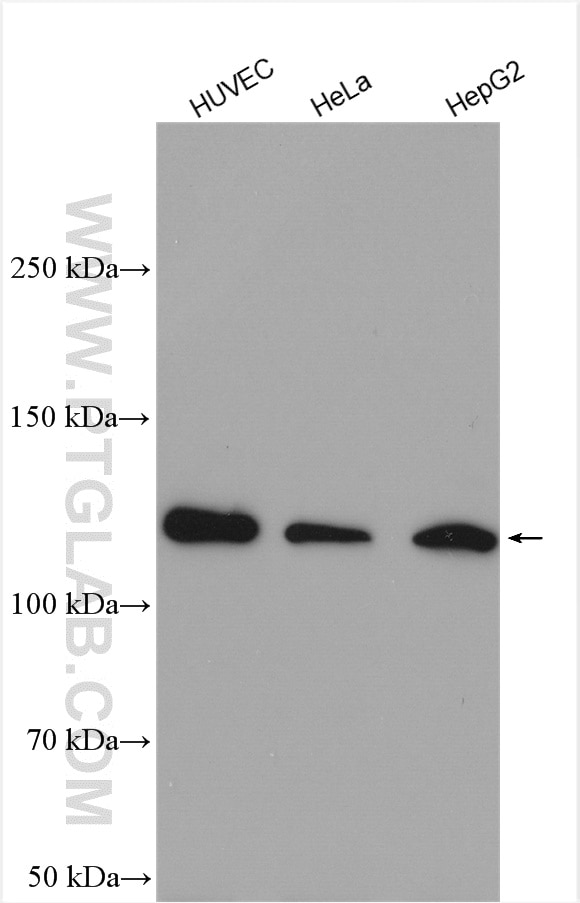 Western Blot (WB) analysis of various lysates using SREBF2 Polyclonal antibody (28212-1-AP)