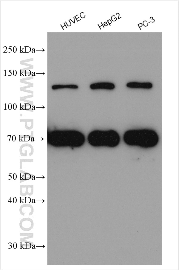 Western Blot (WB) analysis of various lysates using SREBF2 Polyclonal antibody (28212-1-AP)