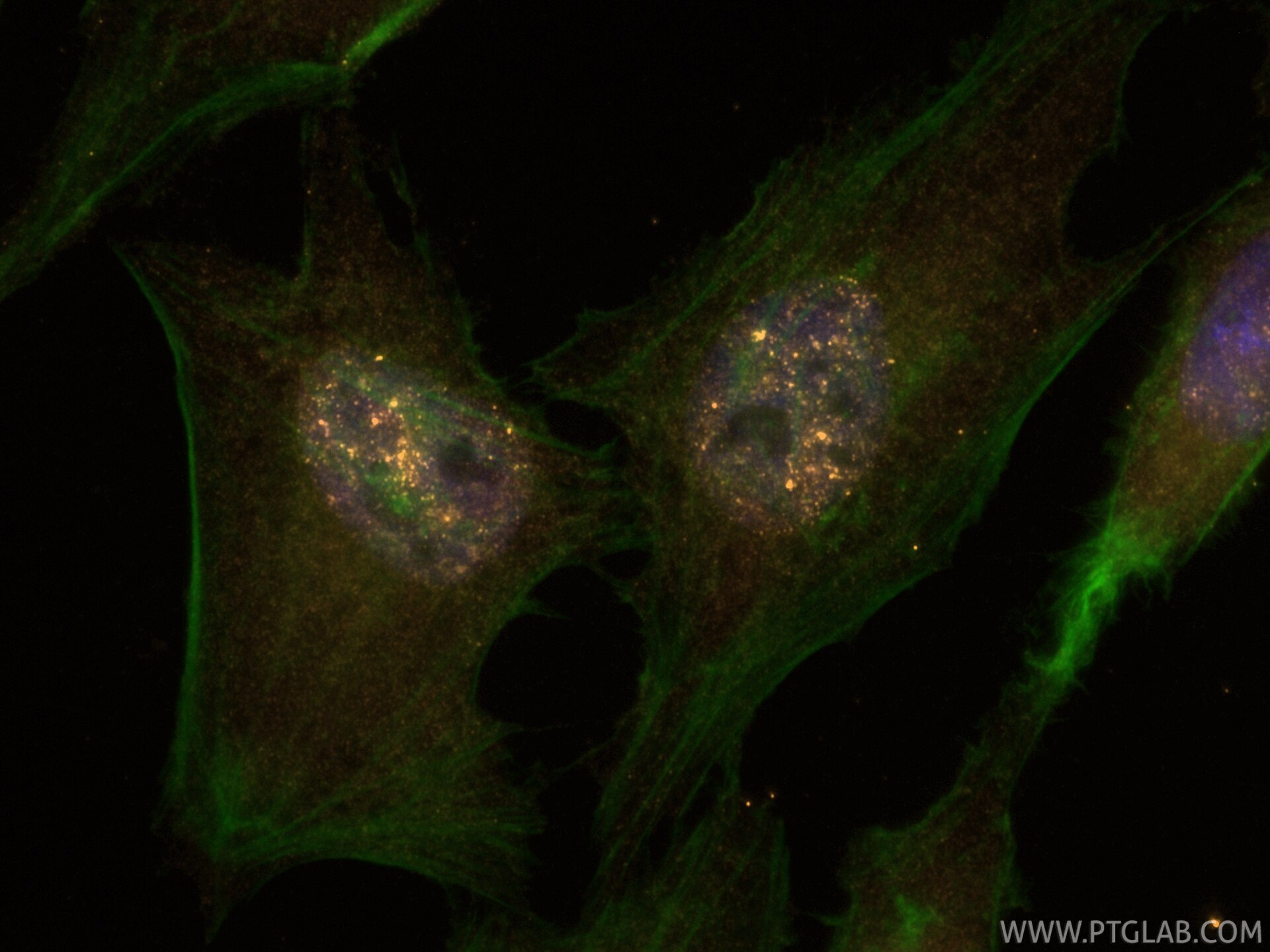 Immunofluorescence (IF) / fluorescent staining of HeLa cells using CoraLite® Plus 555-conjugated SREBF2 Recombinant m (CL555-83403)