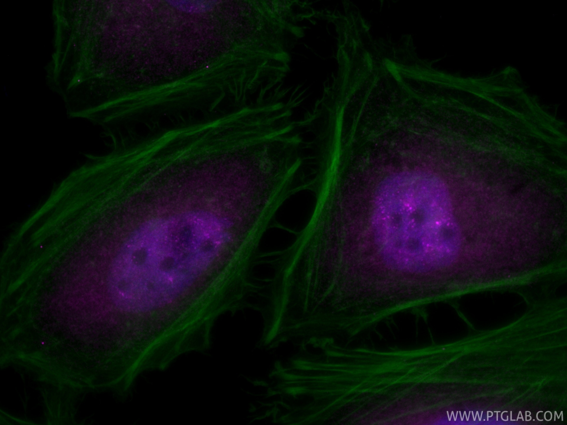 Immunofluorescence (IF) / fluorescent staining of HeLa cells using CoraLite® Plus 647-conjugated SREBF2 Recombinant m (CL647-83403)