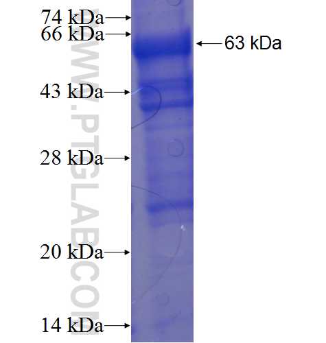 SREBF2 fusion protein Ag5967 SDS-PAGE
