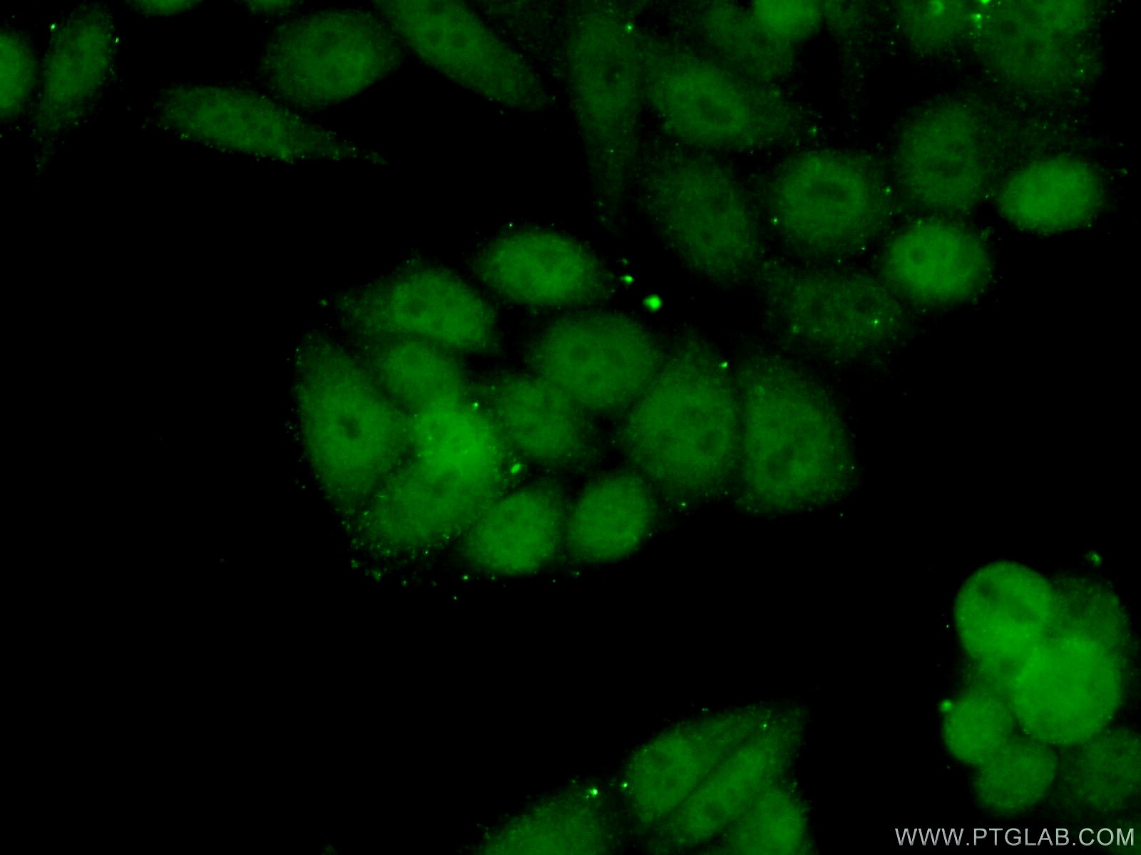 Immunofluorescence (IF) / fluorescent staining of HeLa cells using SRF Polyclonal antibody (16821-1-AP)