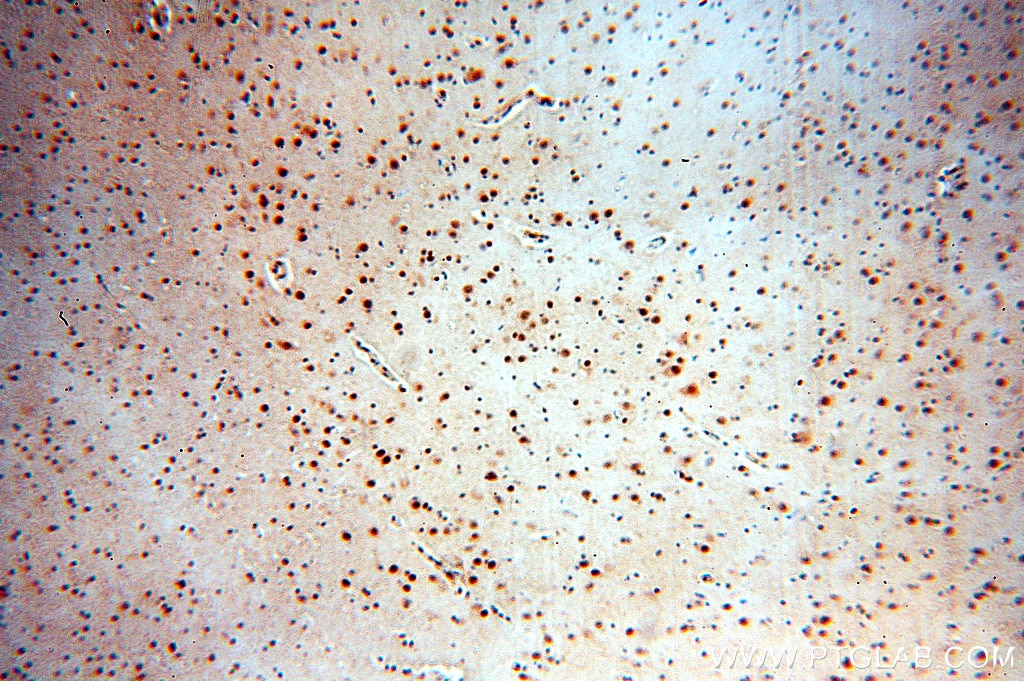 Immunohistochemistry (IHC) staining of human brain tissue using SRF Polyclonal antibody (16821-1-AP)