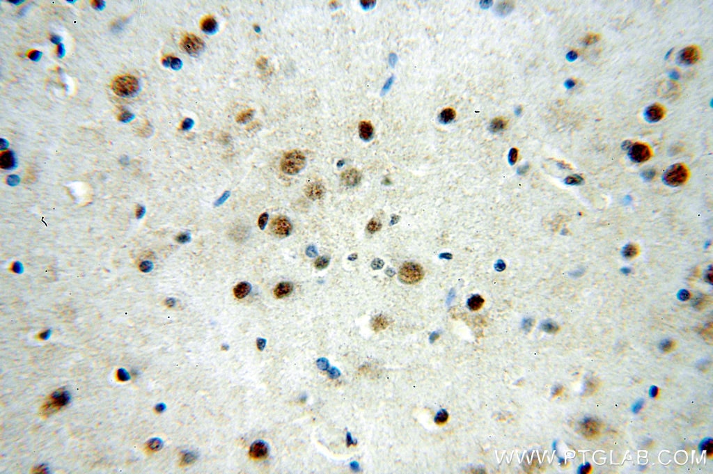 Immunohistochemistry (IHC) staining of human brain tissue using SRF Polyclonal antibody (16821-1-AP)