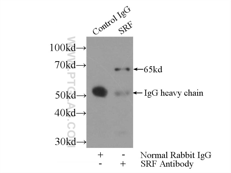 Immunoprecipitation (IP) experiment of HeLa cells using SRF Polyclonal antibody (16821-1-AP)