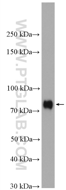 Western Blot (WB) analysis of K-562 cells using SRF Polyclonal antibody (16821-1-AP)