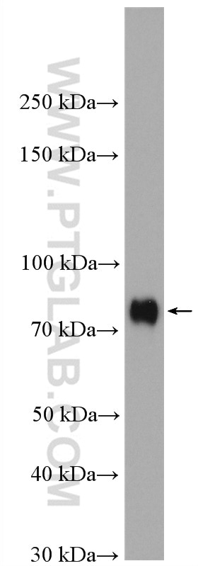 WB analysis of K-562 using 16821-1-AP