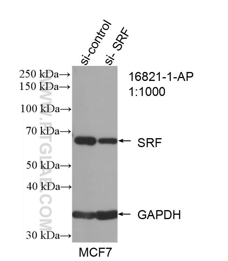 Western Blot (WB) analysis of MCF-7 cells using SRF Polyclonal antibody (16821-1-AP)