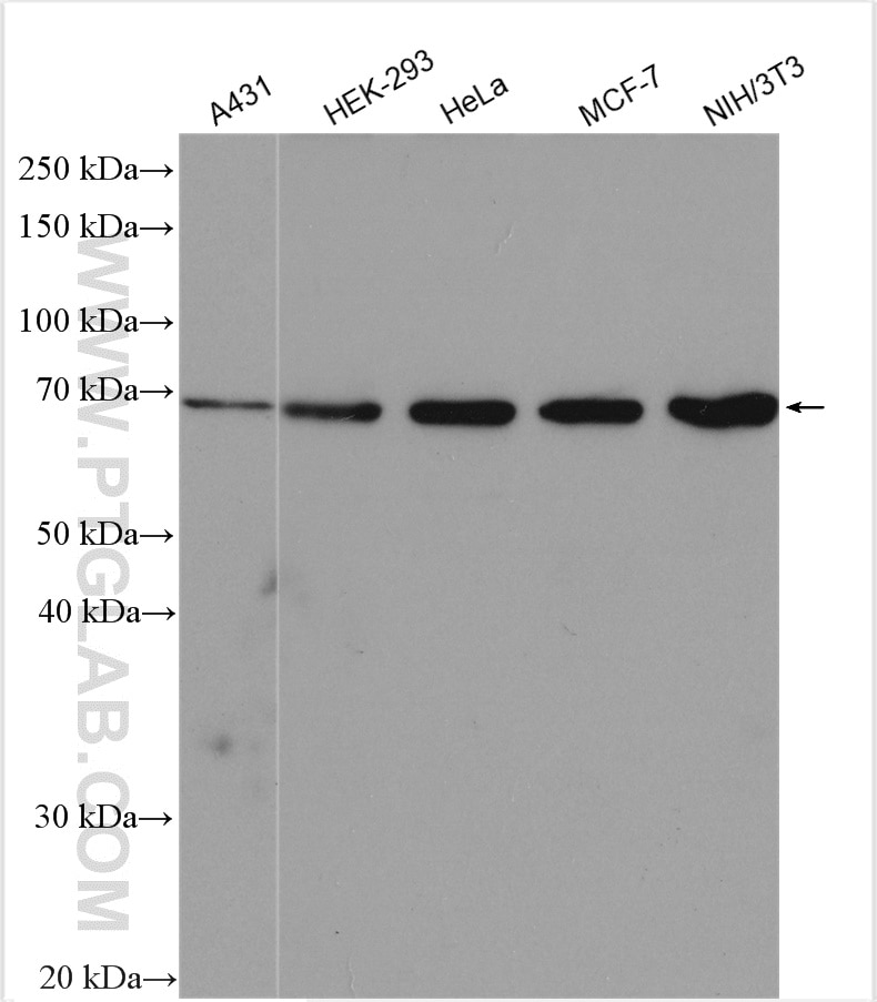 Western Blot (WB) analysis of various lysates using SRF Polyclonal antibody (16821-1-AP)
