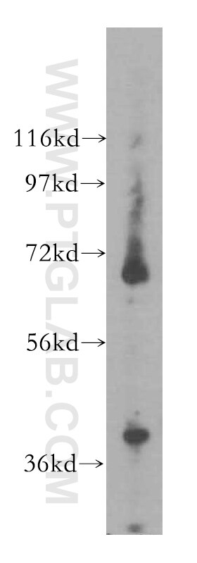 SRF Polyclonal antibody