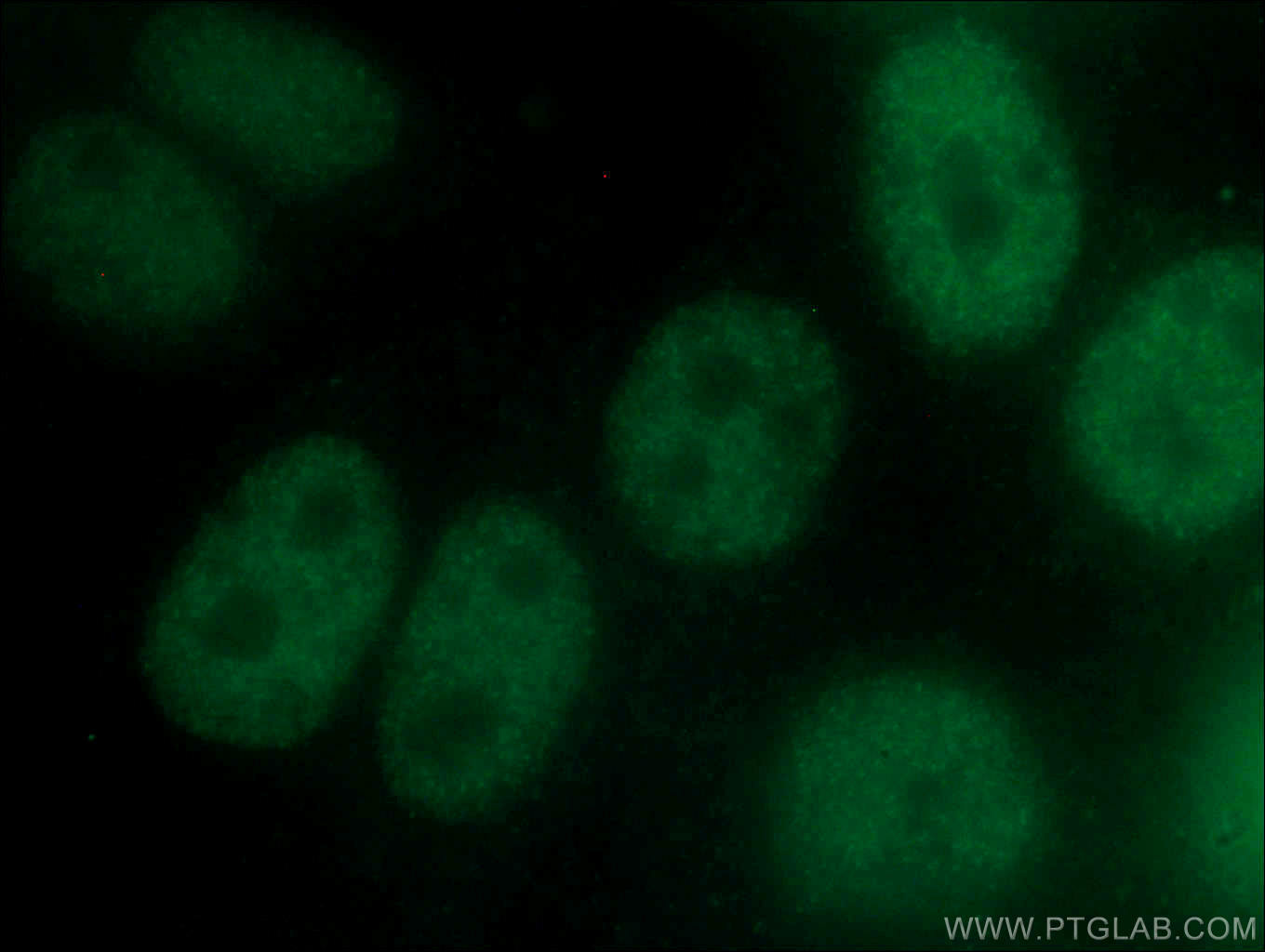 Immunofluorescence (IF) / fluorescent staining of HepG2 cells using SRF Monoclonal antibody (66742-1-Ig)