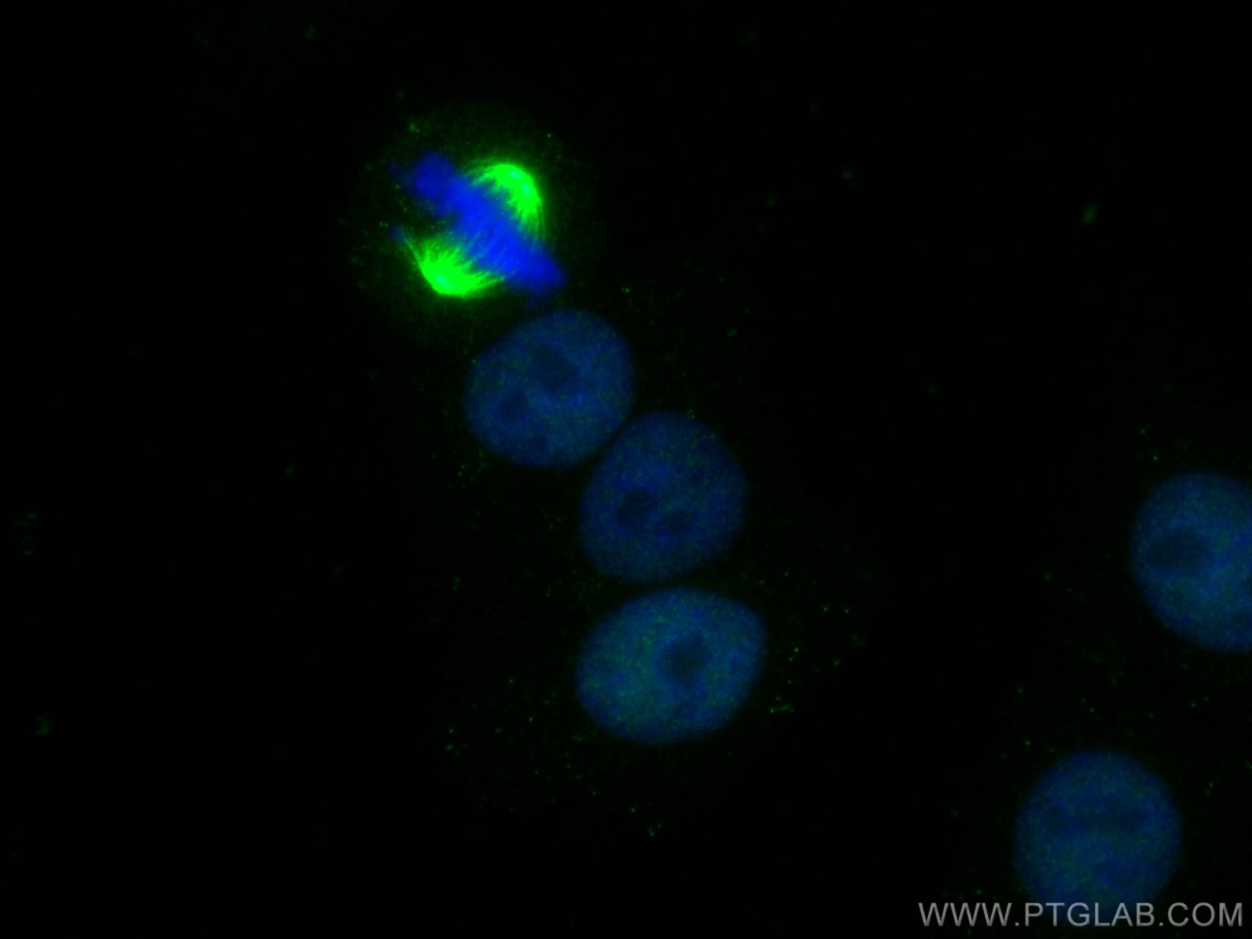 Immunofluorescence (IF) / fluorescent staining of HepG2 cells using SRF Monoclonal antibody (66742-1-Ig)