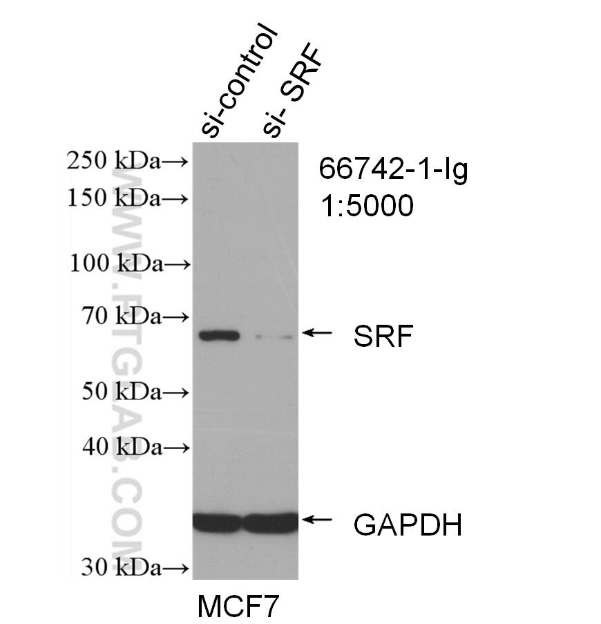 Western Blot (WB) analysis of MCF-7 cells using SRF Monoclonal antibody (66742-1-Ig)