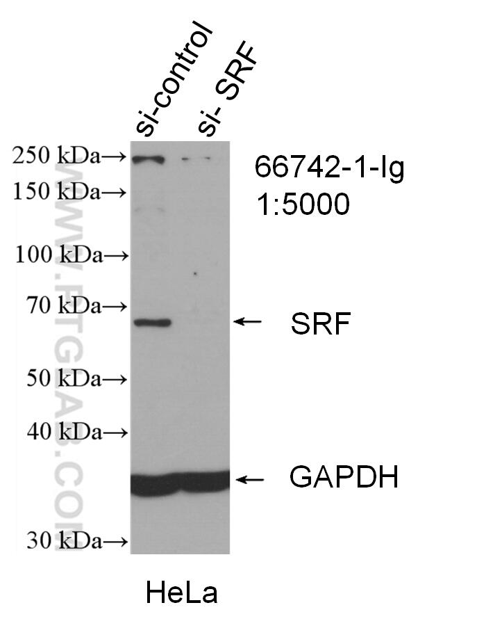 Western Blot (WB) analysis of HeLa cells using SRF Monoclonal antibody (66742-1-Ig)
