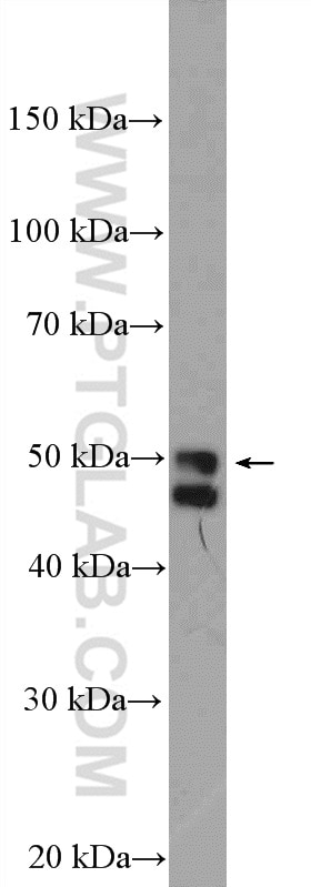 Western Blot (WB) analysis of HeLa cells using SRFBP1 Polyclonal antibody (12792-1-AP)