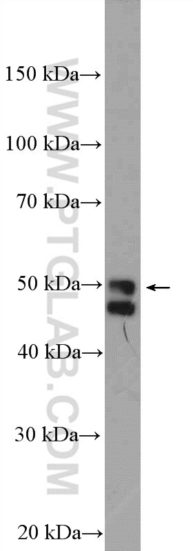 WB analysis of HeLa using 12792-1-AP