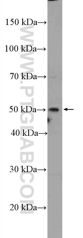 Western Blot (WB) analysis of mouse heart tissue using SRFBP1 Polyclonal antibody (12792-1-AP)